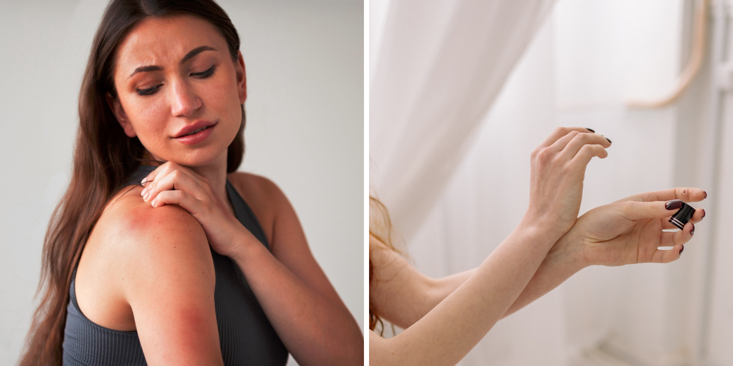 Tame the Itch The Best Essential Oil for Itchy Skin