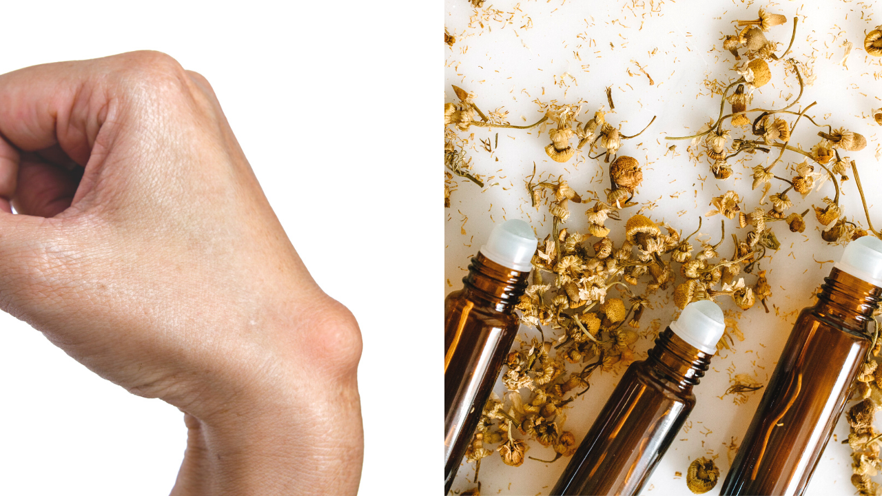 Essential Oils for Cysts 7 Solutions to Get Rid of Those Pesky Bumps!