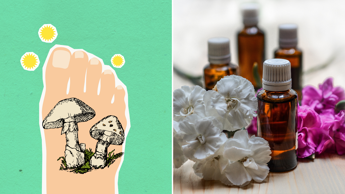Soothe Athlete’s Foot With These 7 Healing Essential Oils