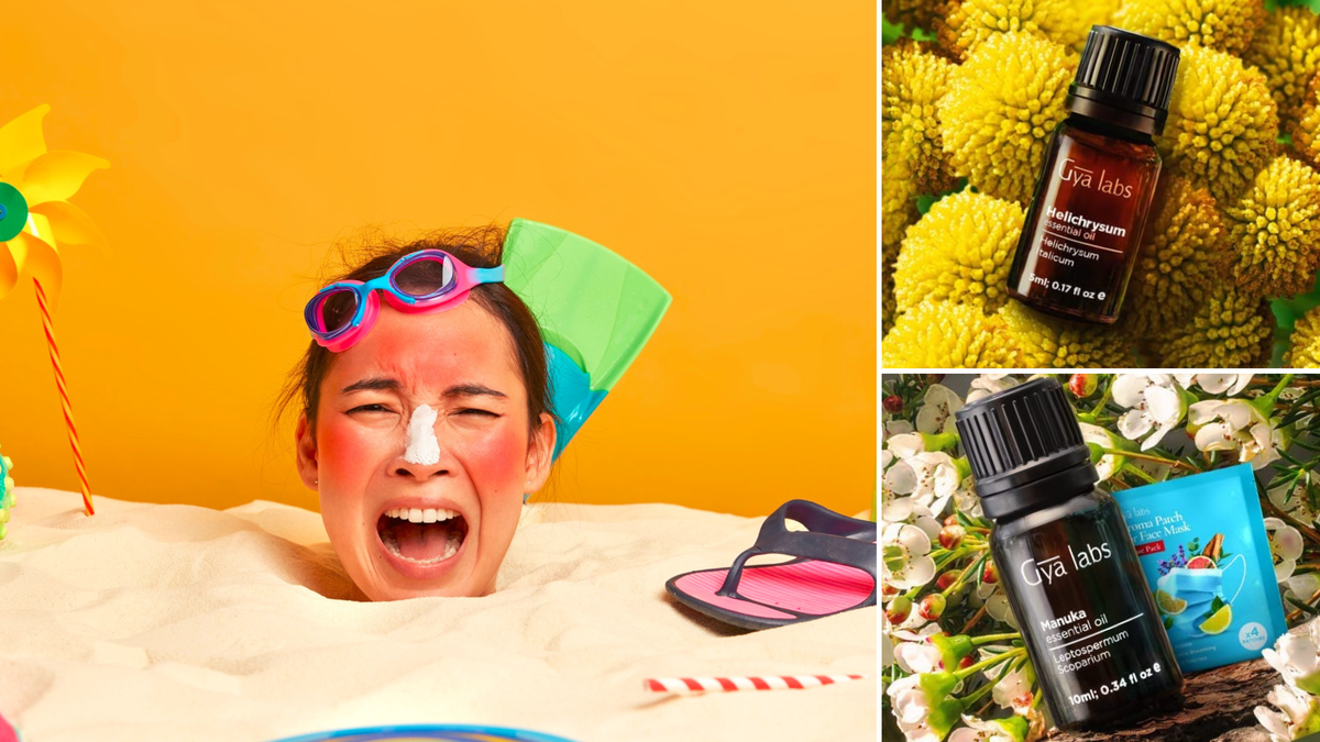 8 Essential Oils for Burns to Accelerate Healing!