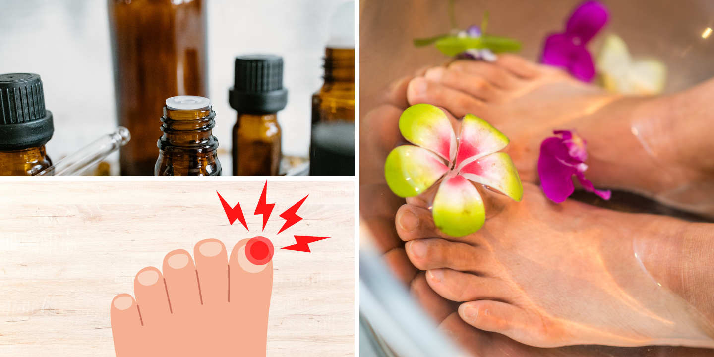 Heal Ingrown Toenails with the Power of Essential Oils
