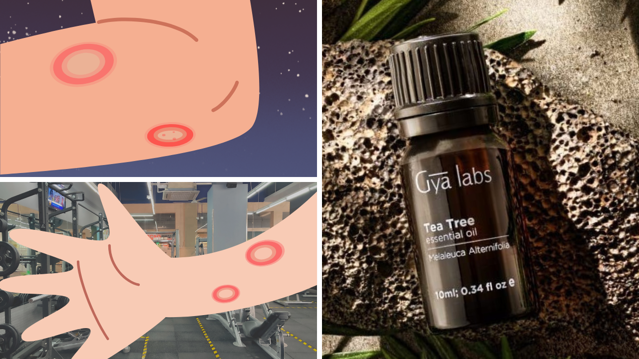 Top 7 Essential Oils for Ringworm Relief Get Rid of the Itch!