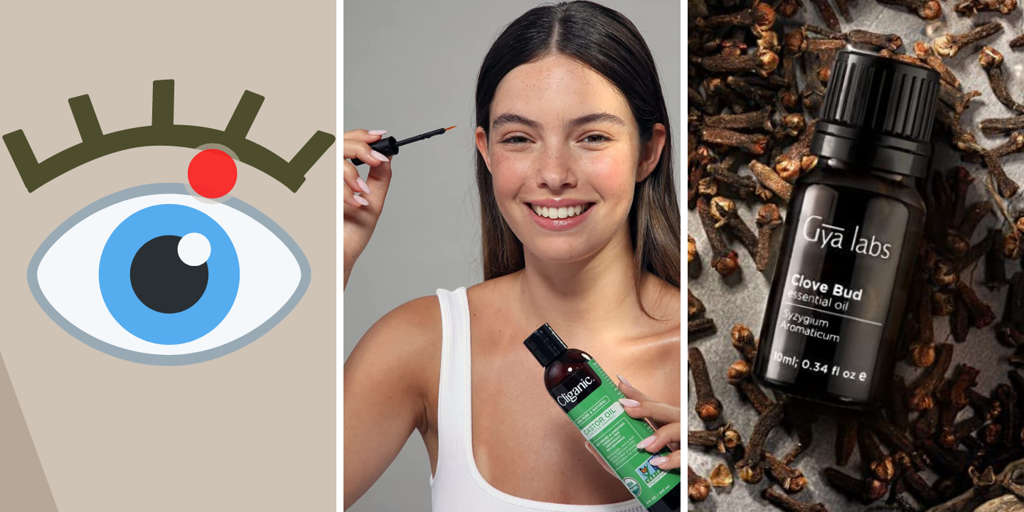 Best Essential Oils to Treat a Stye Naturally